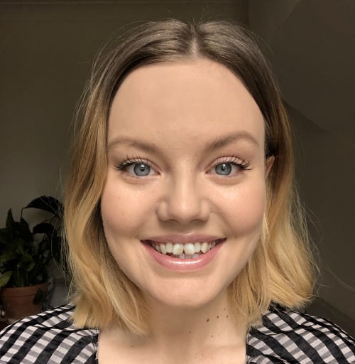invisalign smileview before, stomatološka ordinacija mondent